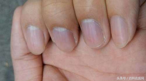 肝火旺的五大症状及调节方法,肝火旺的十大症状怎么调理