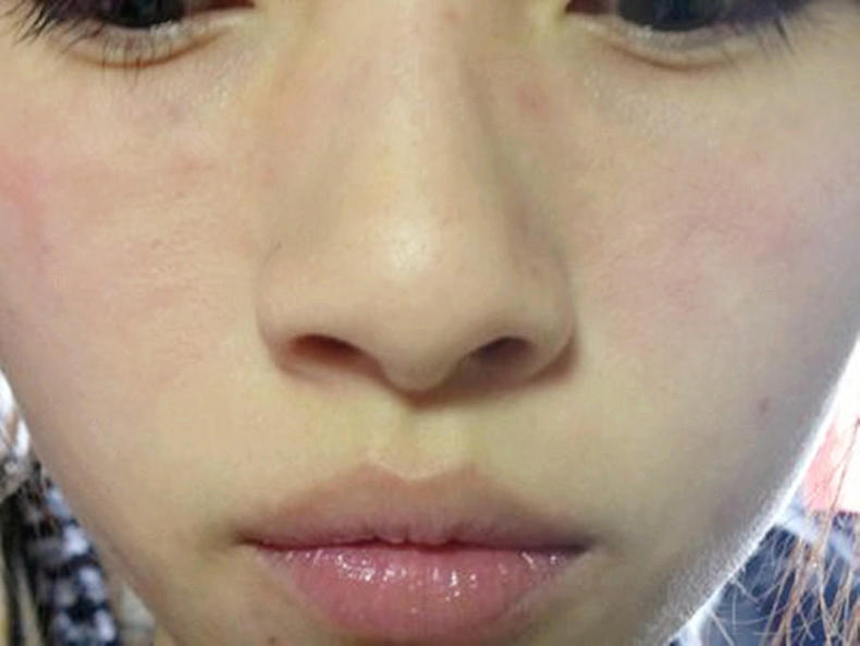 花了那么多钱，你的皮肤有好过吗？