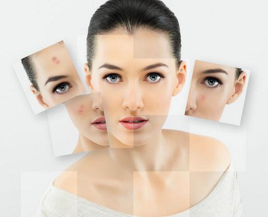 激光漂白皮肤,皮肤漂白能永远保持吗