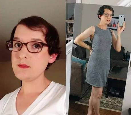 男人服用大量雄性激素会怎么样,男生长期服用雌性激素会怎么样