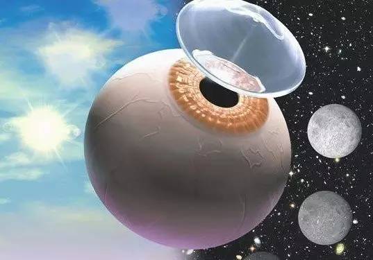 隐形眼镜刚买回来需要关注什么,第一次配眼镜需要关注什么事项