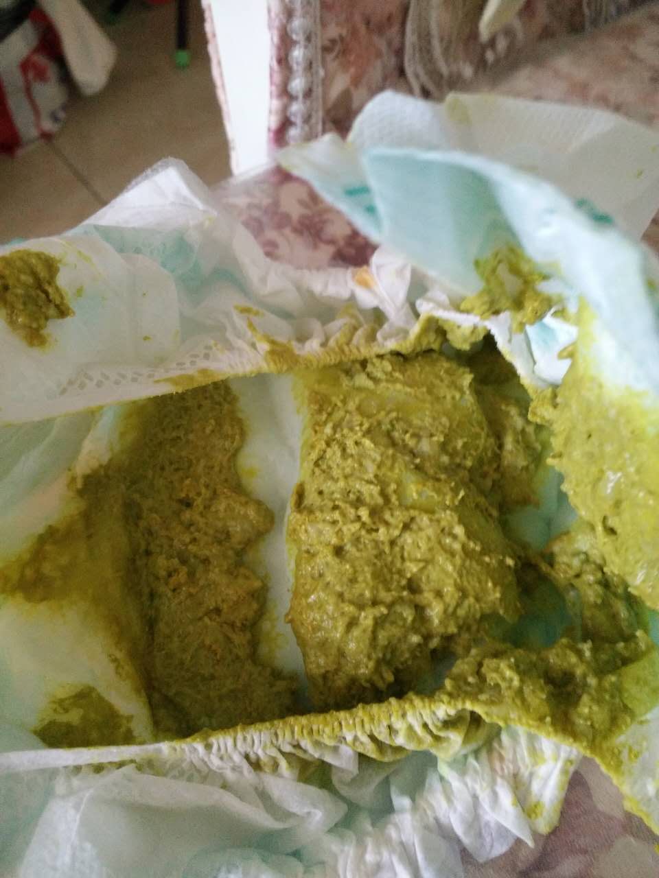 2周岁轮状病毒,轮状病毒疫苗2周岁还可以打吗