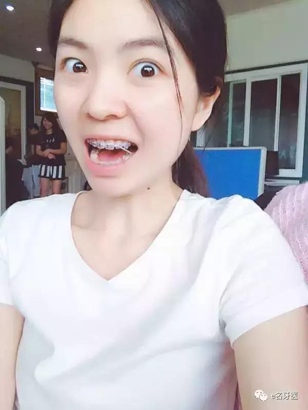 有牙洞并感觉到疼痛了,有牙洞很疼怎么办