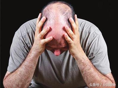 脱发脱成秃头了怎么办,地中海脱发一年多了还能长回来吗