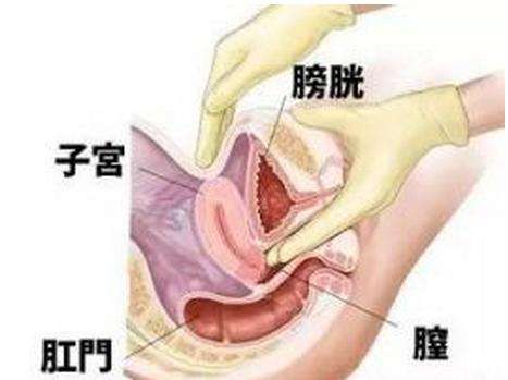 每次孕检都让医生无奈，内检让人羞涩，简直有毒