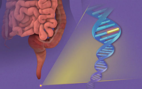 结直肠癌手术后肝转移免疫疗法,结直肠癌伴肝转移的ct表现