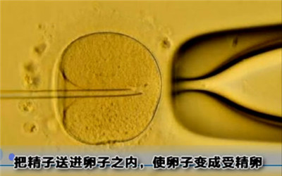 做试管婴儿手术身体是不是很遭罪,人工授精遭罪还是试管婴儿遭罪