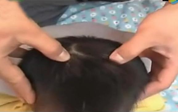 湘西点穴治疗脑瘫的名医,小儿脑瘫推拿疗法