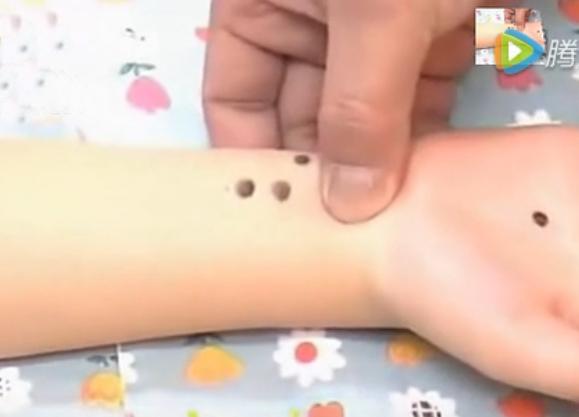 湘西点穴治疗脑瘫的名医,小儿脑瘫推拿疗法