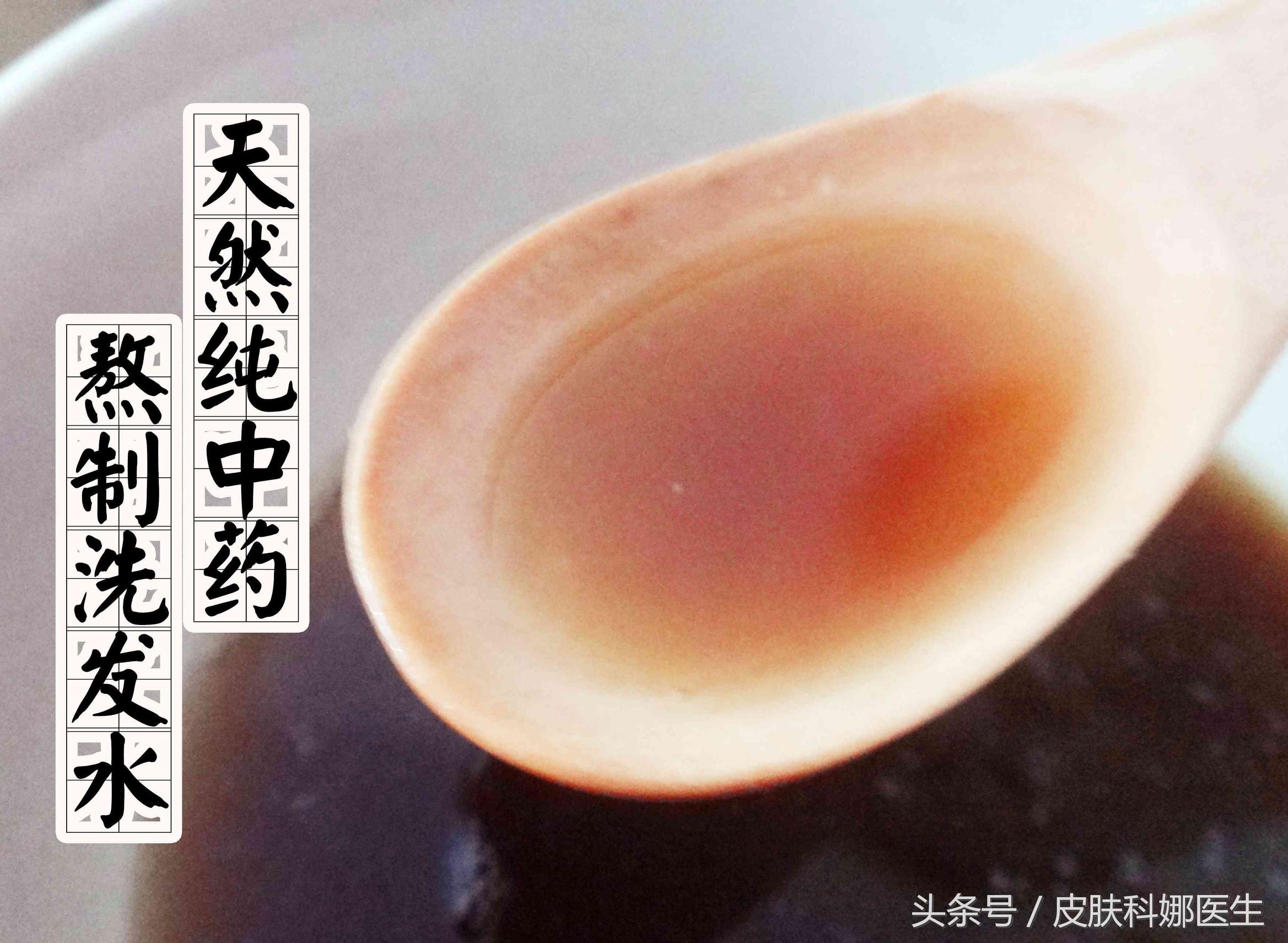 头皮出油多、瘙痒、起红包、皮屑多，还掉头发，中药洗头帮忙搞定