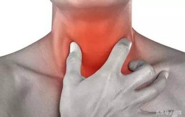 咽喉部干痒咳嗽是什么原因,咽喉痒是什么原因引起的