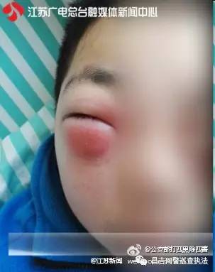 男孩玩游戏48小时失明,12岁男孩玩游戏48个小时眼睛失明