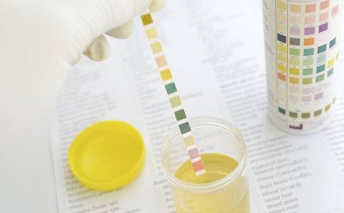 「健康」尿常规报告上这几个指标，告诉你肾好不好！