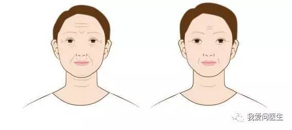 脸上苹果肌上有凹沟填充什么,涨姿势视觉冲击