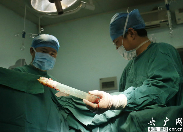 杭州男子肛门被塞20公分长振动棒称年会被恶搞（图