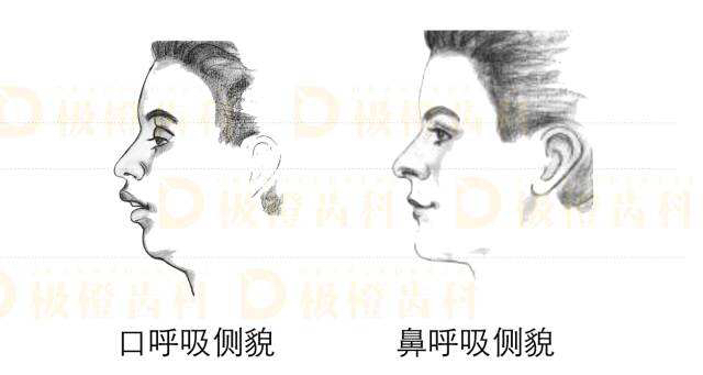 四个月宝宝睡觉有吸允动作正常吗,四个月宝宝睡着总是吸吮