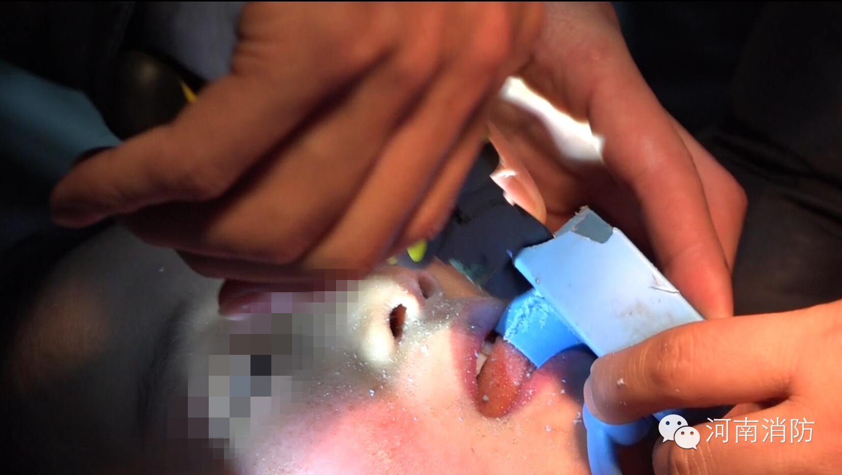 心疼，女童舌头被卡痛的哇哇大哭，只因喝水的时候做了这个动作！