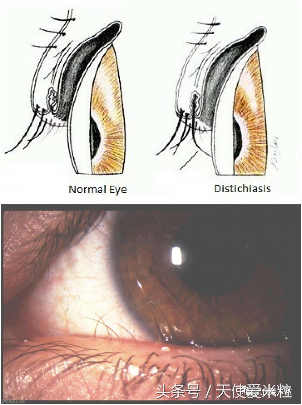 好莱坞明星的惊人变化,好莱坞明星们20年来的变化