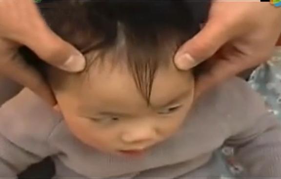 湘西点穴治疗脑瘫的名医,小儿脑瘫推拿疗法