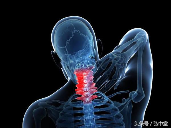 弘中堂：颈椎病新疗法