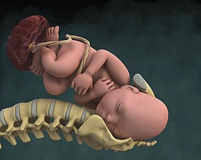 怎么缓解孕期坐骨神经臀部痛,孕期坐骨神经痛腿疼如何缓解