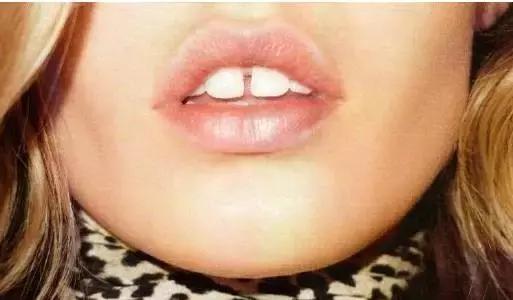 前面牙缝大漏财真的吗,牙缝大是有福气还是漏财