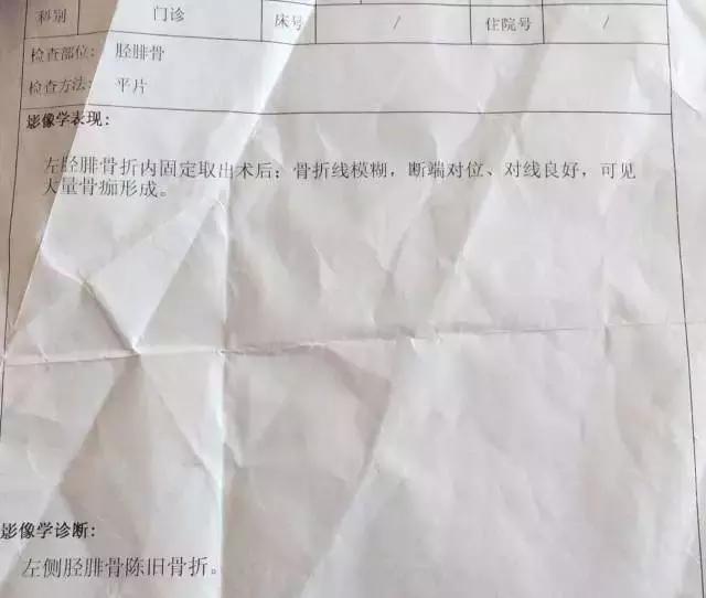 骨折内固定伤口处流脓是为什么,骨折固定支架外部流脓怎么处理