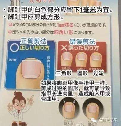 嵌甲性甲沟炎自己最佳治疗方法,嵌甲甲沟炎根治教程