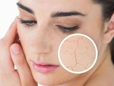 热气上火喝什么养生茶最好,能让暑热上火远离你的5杯茶