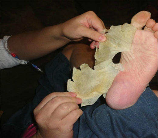 日本一大妈抠脚皮赚1亿,日本大爷靠撕脚皮狂赚20亿