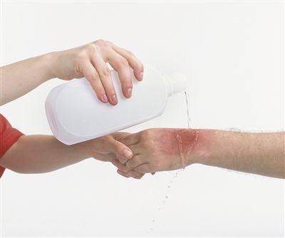 小孩脚背烫伤有什么好方法,宝宝脚烫伤后期护理