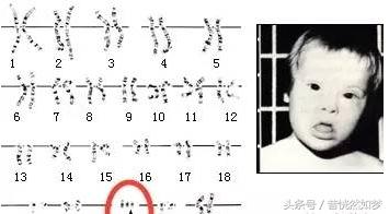 唐筛有问题医院会提前通知你吗,唐筛有问题再做无创还是羊水穿刺