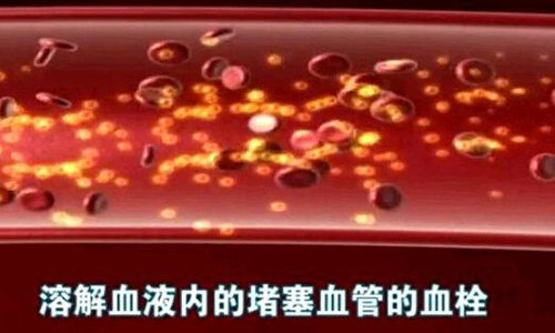 视线模糊吃什么中药,视线模糊吃什么中成药好