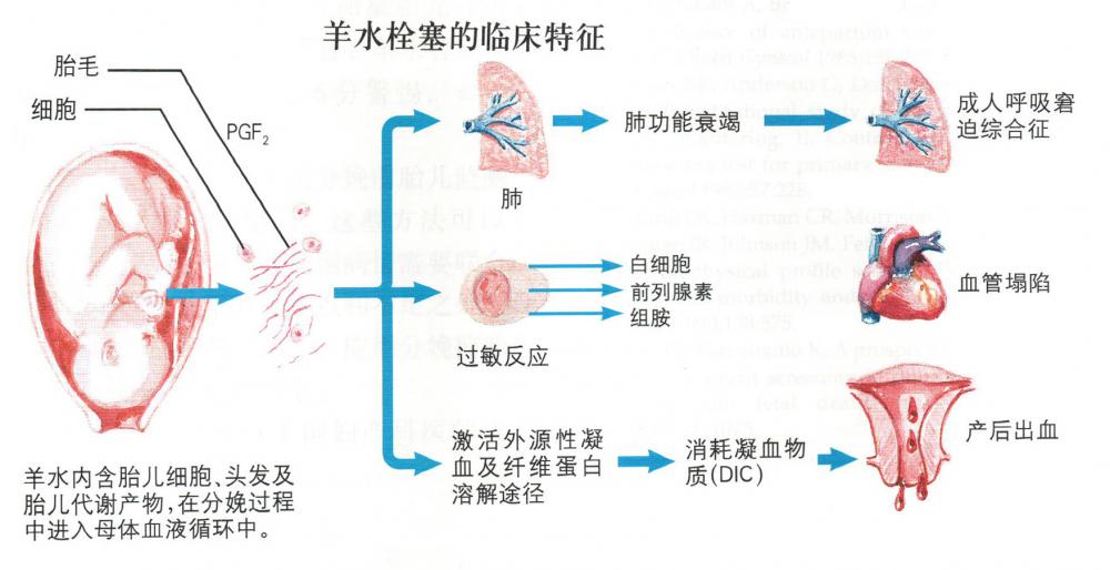 场面震撼！台州20多位医生联手用60袋血击败“死神”救产妇