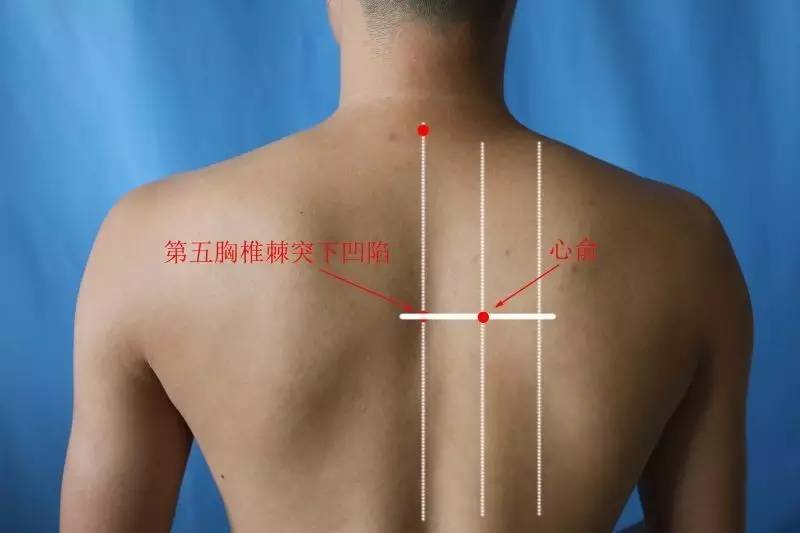 心梗疼痛打止疼针有用吗,心梗中医扎针治疗方法