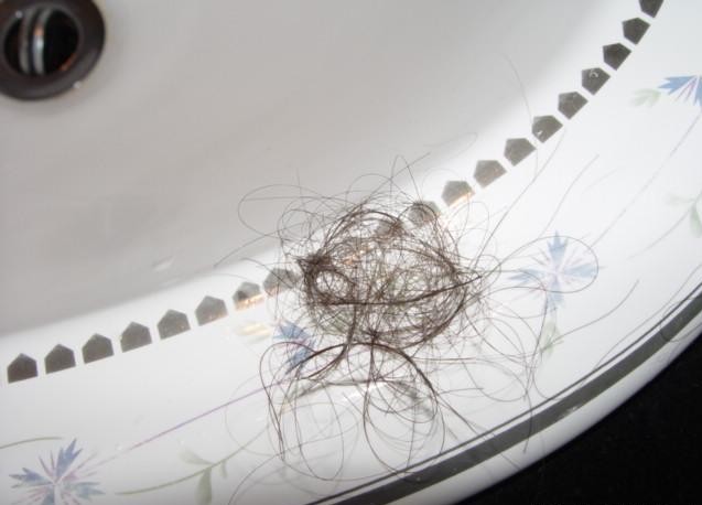 年轻人头顶脱发能恢复是真的吗,为什么现在的人脱发掉发严重