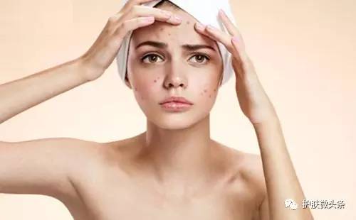 挤痘留下的疤怎么办,鼻翼挤痘留下增生性痘印