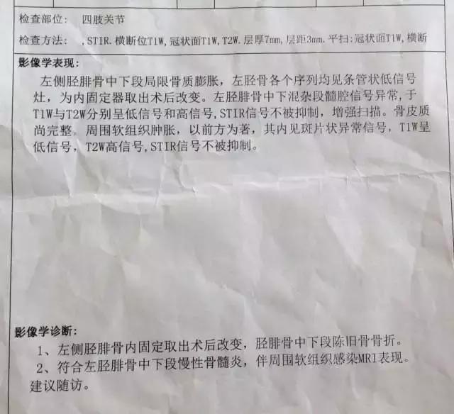 骨折内固定伤口处流脓是为什么,骨折固定支架外部流脓怎么处理