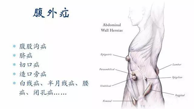 疝气要不要做手术,疝气手术10天恢复图
