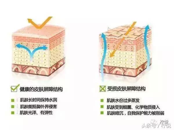 舒淇经常过敏,舒淇过敏好了吗