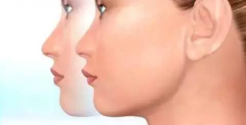 如何一秒钟矫正牙齿,牙齿矫正让你悄然改变从现在开始