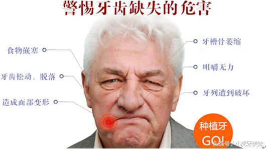 老年人适合的镶牙种类和价格,老年人镶牙选哪种牙比较靠谱