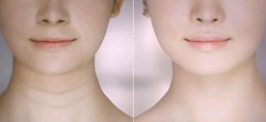 颈部护理到底有多重要,颈部护理每日必备