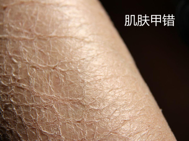 治疗血瘀的经典名方,缓解血瘀经典名方