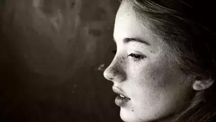 中医雀斑去除的最佳方法,祛雀斑中药