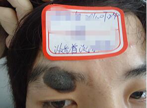 胎记算命揭秘,胎记算命真的可信吗女生