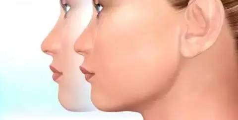 如何一秒钟矫正牙齿,牙齿矫正让你悄然改变从现在开始