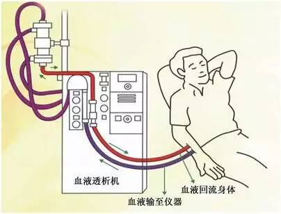 信中医被治成尿毒症,信农村偏方的后果