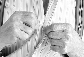 手抖是帕金森综合征吗,手抖未必就是帕金森病