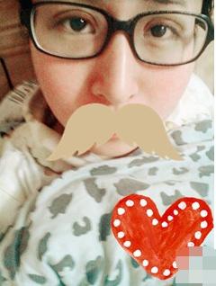 长期用双眼皮胶水变松,长期用胶水粘双眼皮的后果